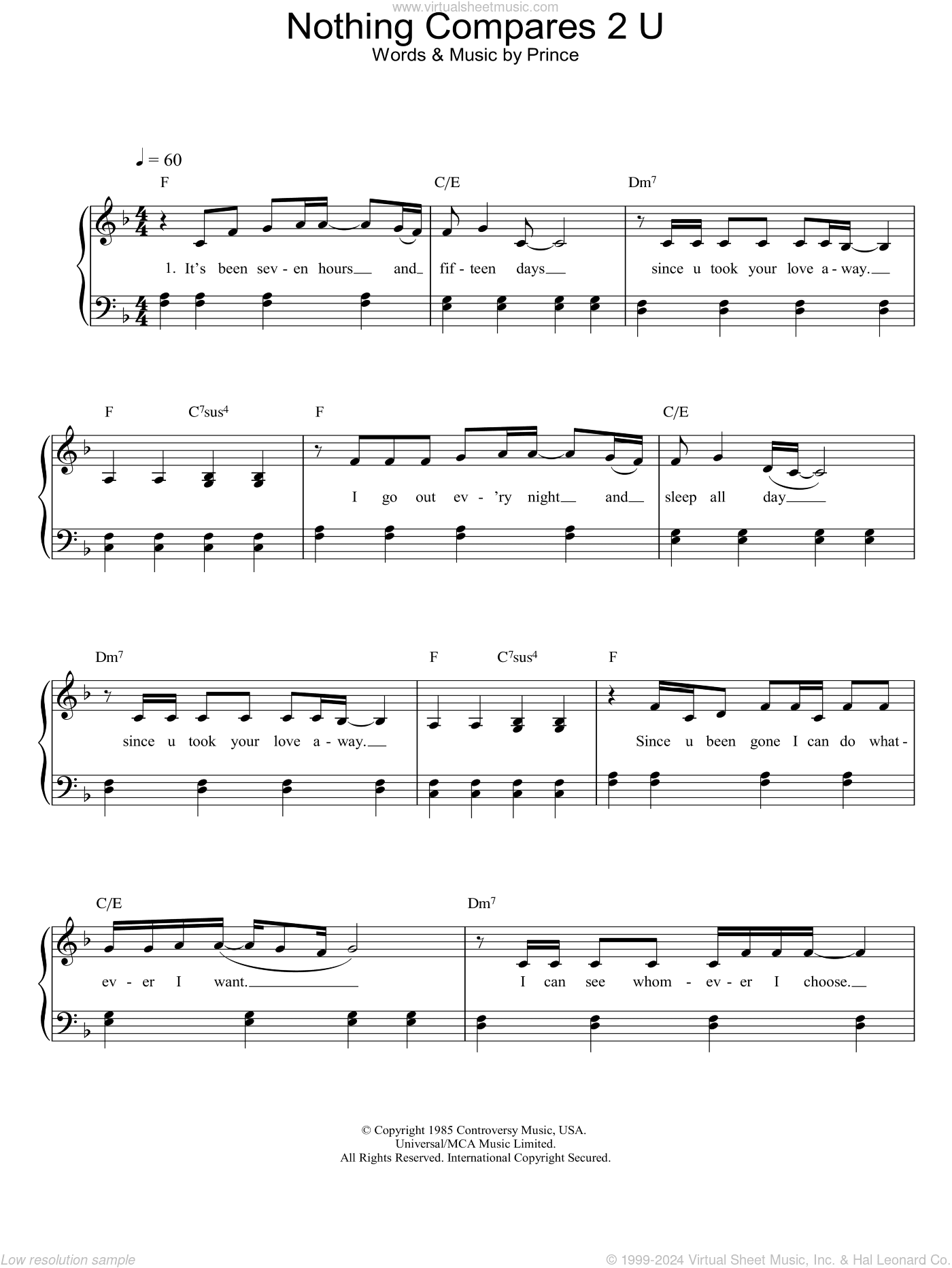 Nothing Compares 2 U, (intermediate)