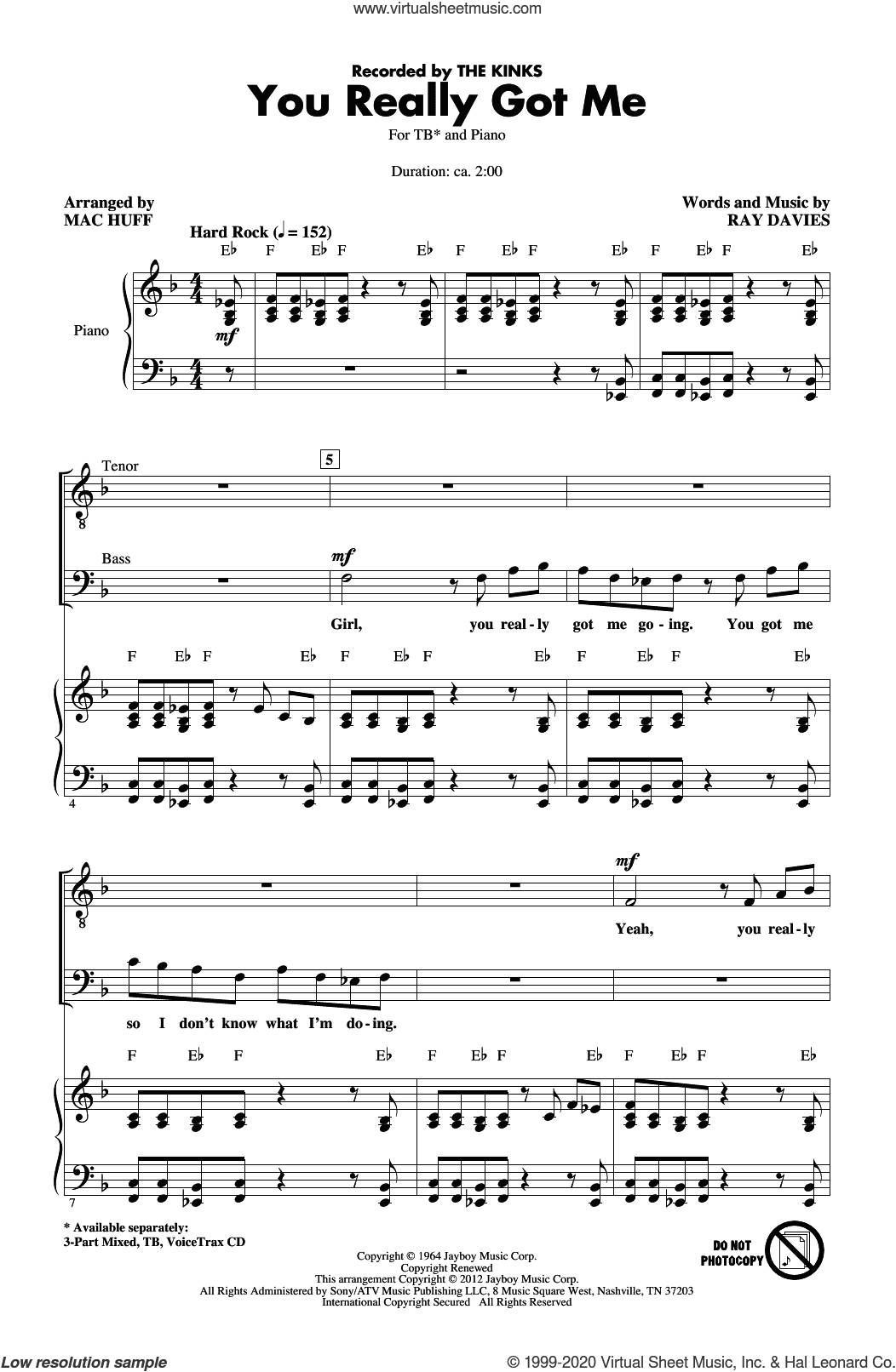 You Really Got Me (arr. Mac Huff)
