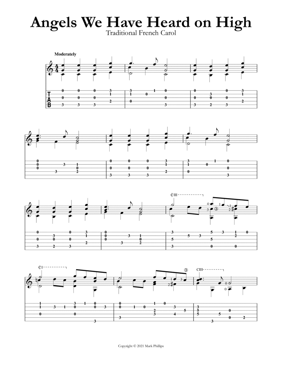 Angels We Have Heard on High (arr. Mark Phillips)