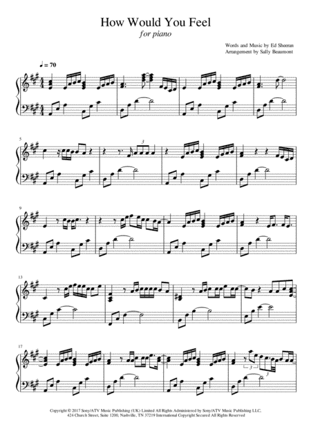 How Would You Feel (paean) (arr. Sally Beaumont)