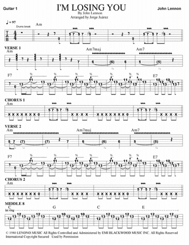 I'm Losing You (arr. Jorge Juárez)
