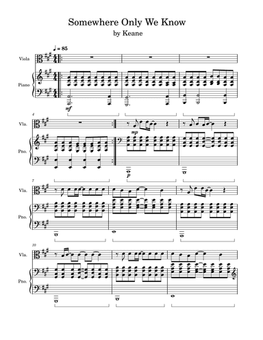 Somewhere Only We Know (arr. Anya Alston)