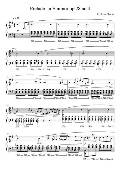 Prelude In E Minor, Op. 28, No. 4 (arr. Gianluca Giovannetti)
