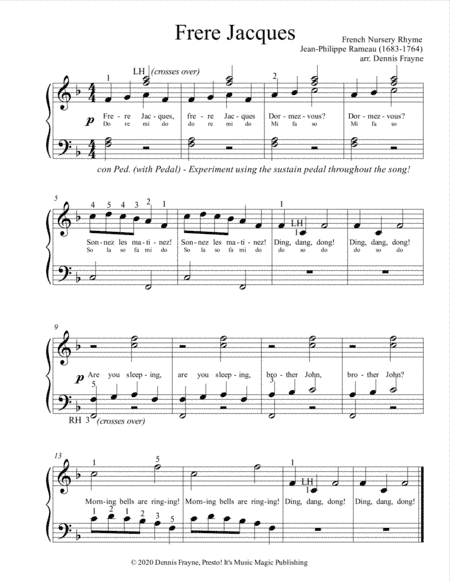 Frere Jacques (Are You Sleeping?) (standard notation) (arr. Dennis Frayne)