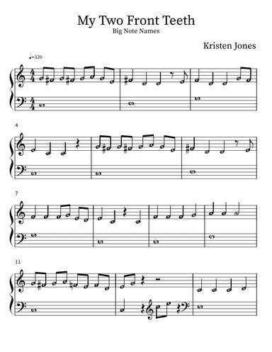 My Two Front Teeth- Big Notes (arr. Kristen Jones)