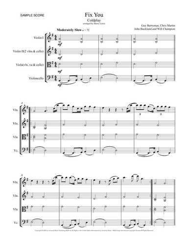 Fix You (arr. Sherry Lewis)