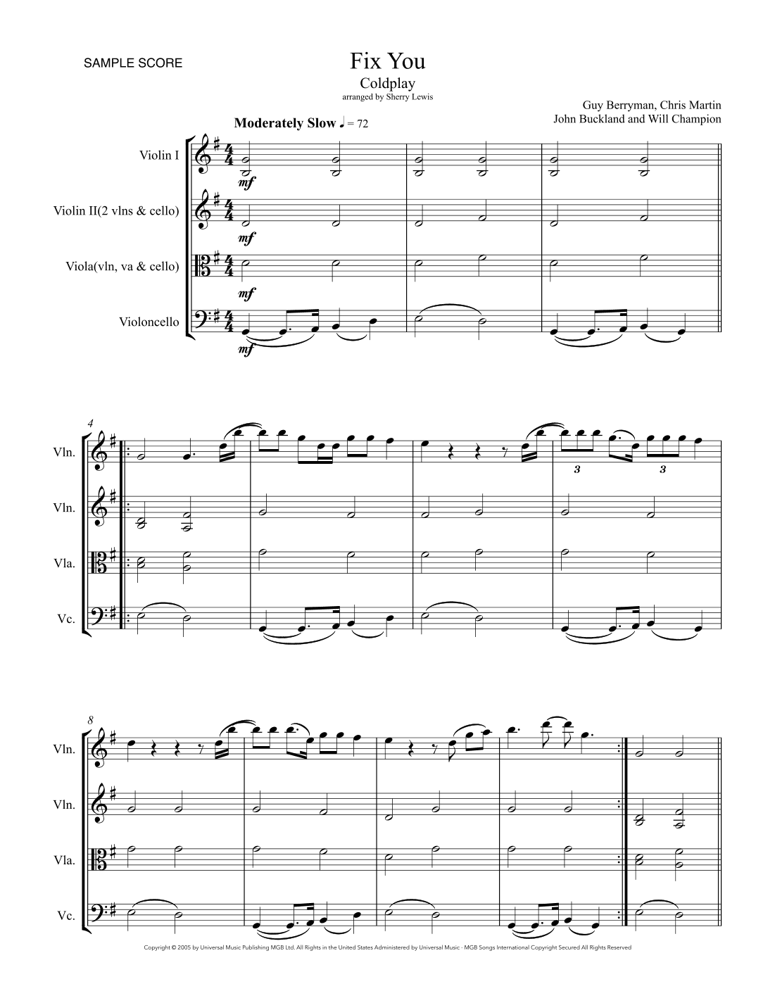Fix You (arr. Sherry Lewis)