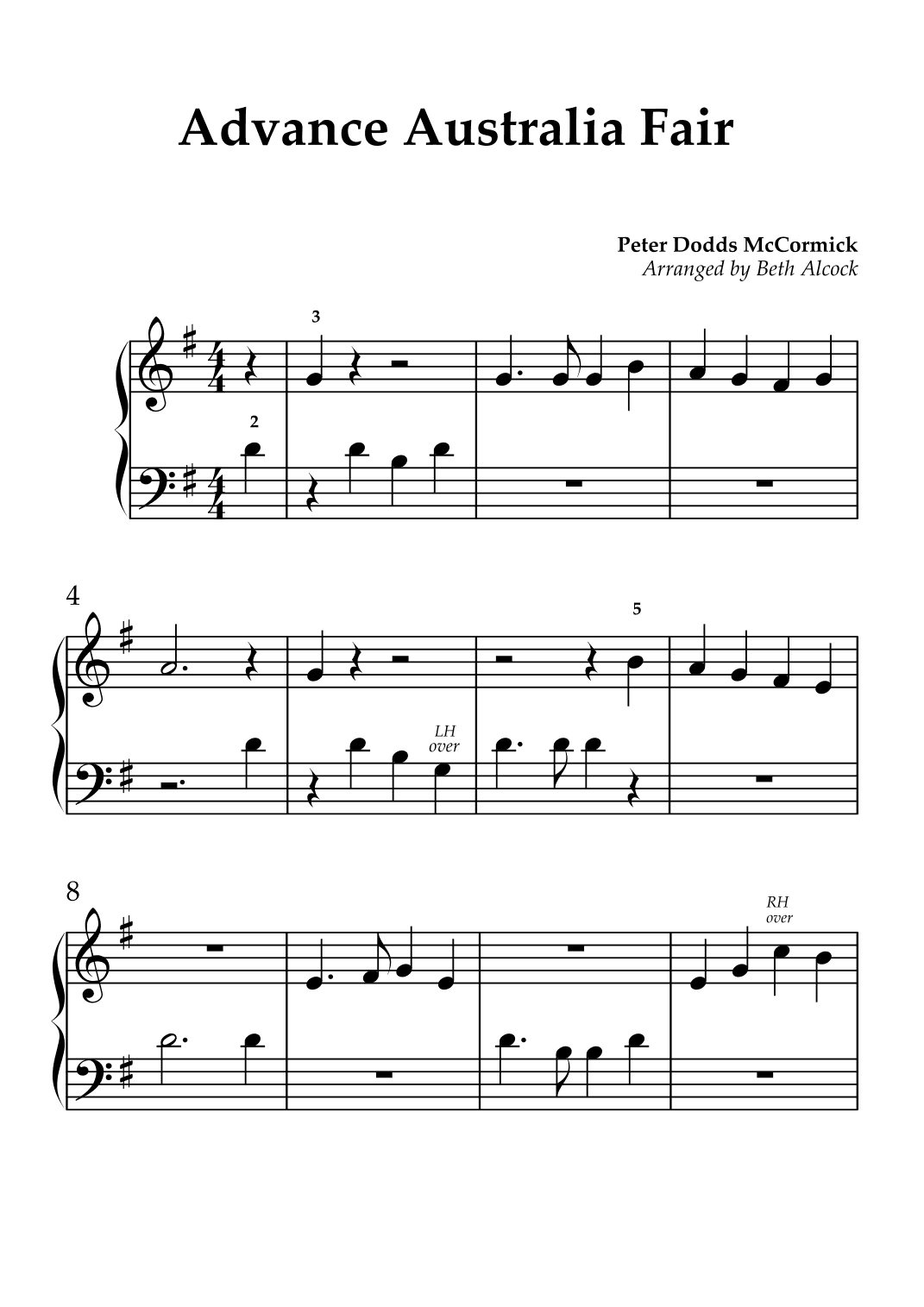 Advance Australia Fair - Easy Piano (arr. Beth Alcock)