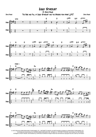 Ziggy Stardust (arr. Antony Cull)