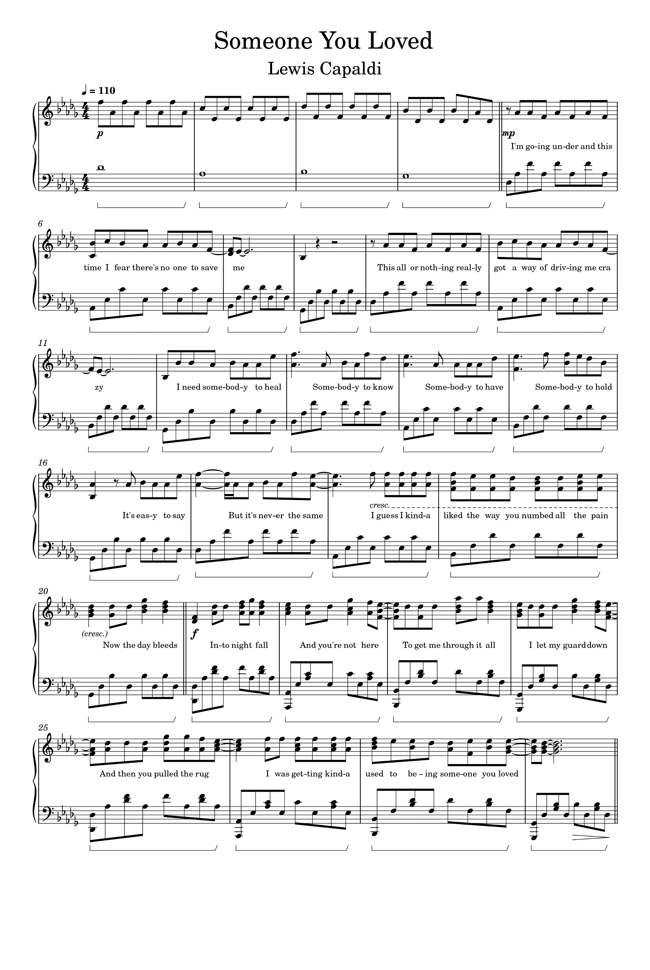 Someone You Loved (arr. Lewis Capaldi)