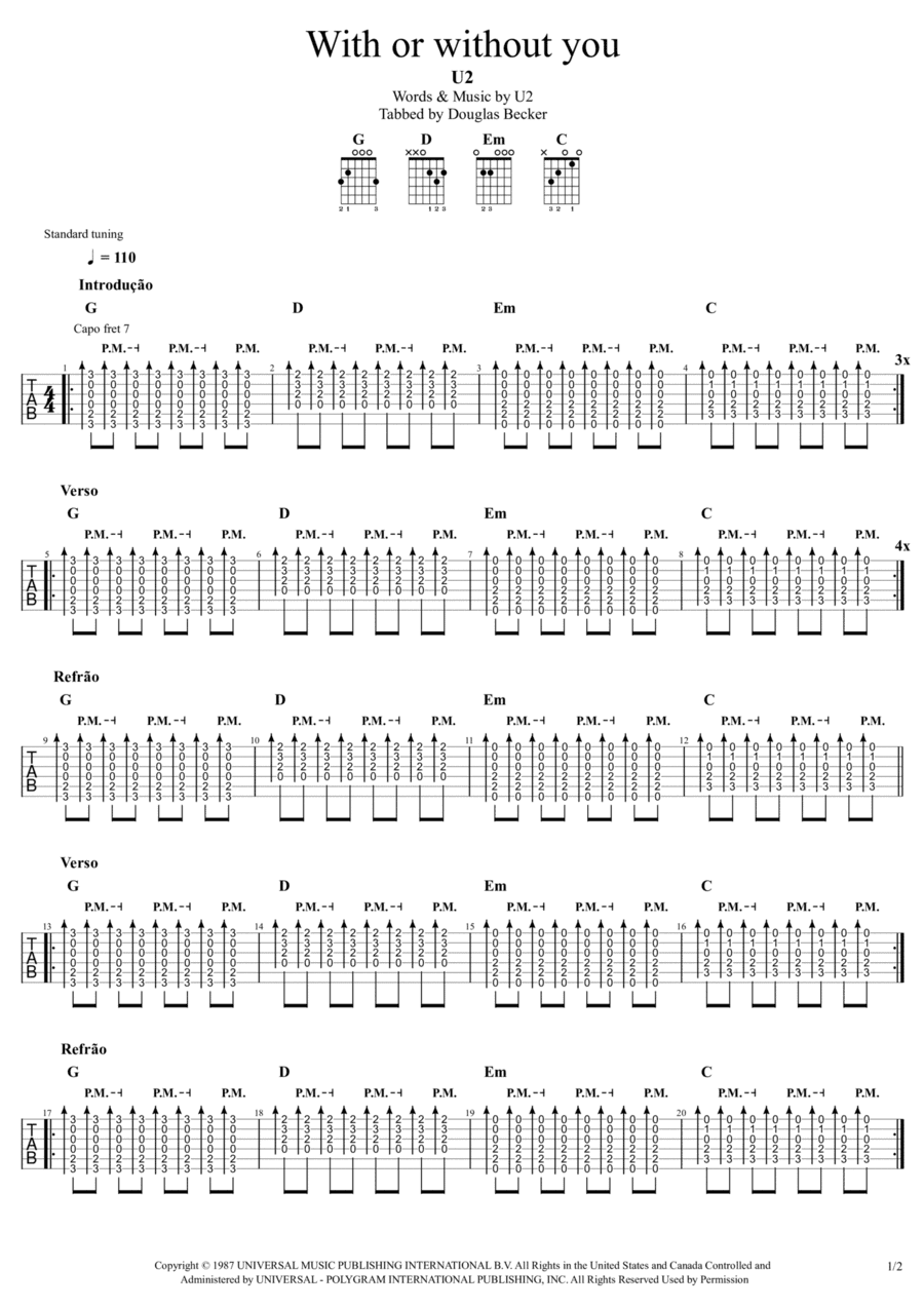 With Or Without You (arr. Douglas Becker)