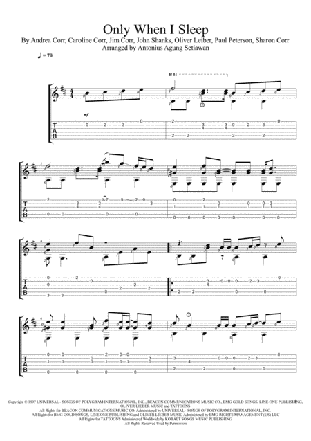 Only When I Sleep (arr. Antonius Agung Setiawan)