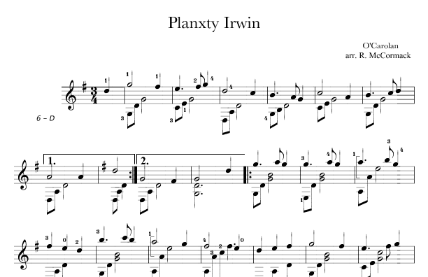 Planxty Irwin (arr. Robert McCormack)