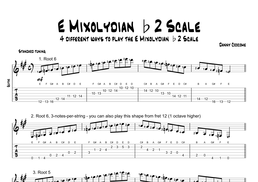 E Mixolydian b2 Scale (4 Ways to Play)