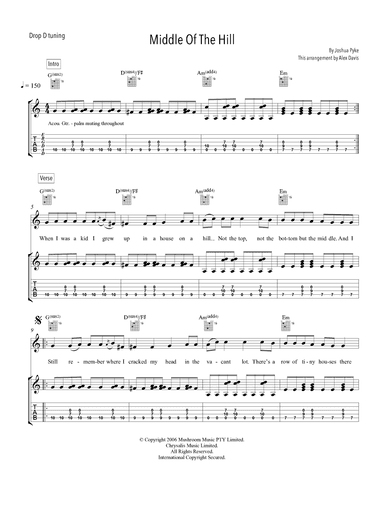 Middle Of The Hill (arr. Alex Davis)