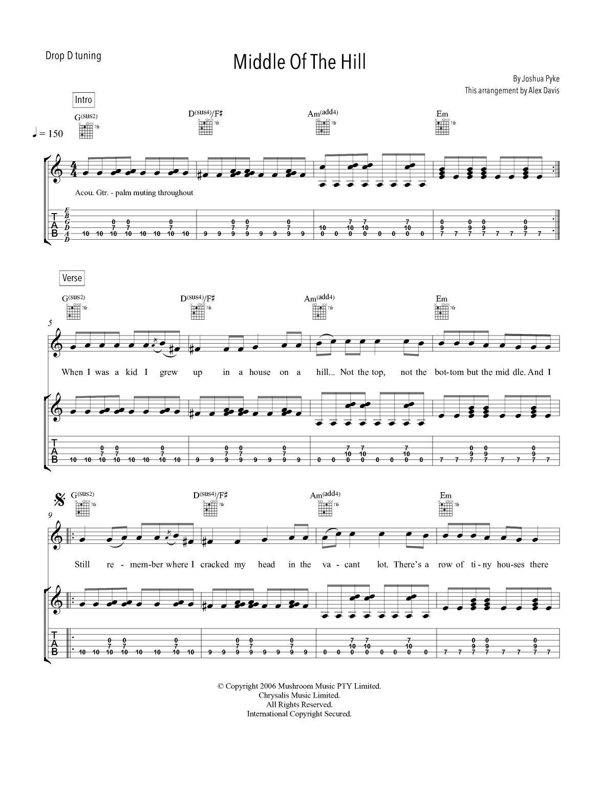 Middle Of The Hill (arr. Alex Davis)