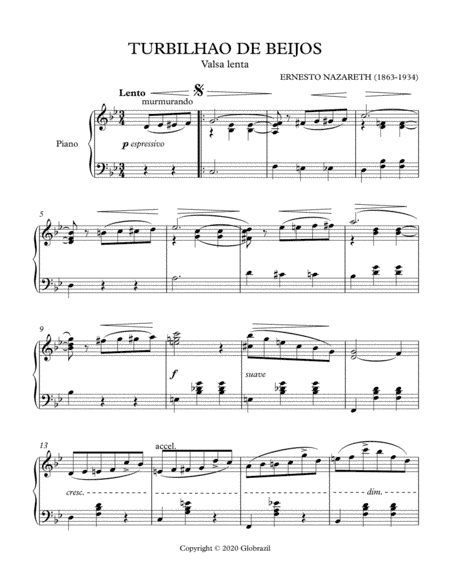 TURBILHAO DE BEIJOS (arr. Globrazil)