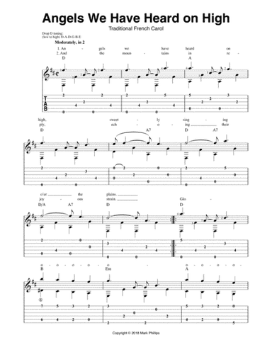 Angels We Have Heard on High (arr. Mark Phillips)