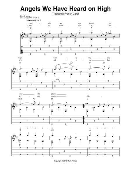 Angels We Have Heard on High (arr. Mark Phillips)
