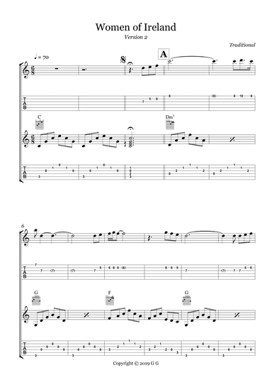 Women of Ireland (C) (arr. Gio G)