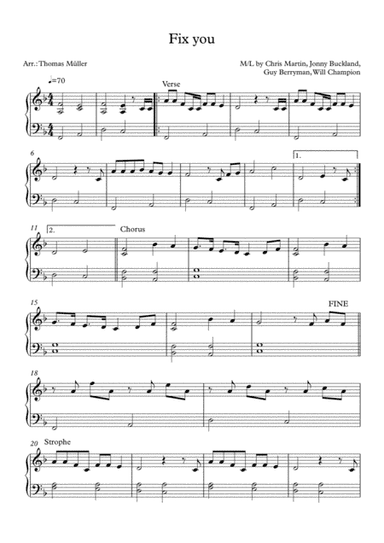 Fix You (arr. Thomas Müller)