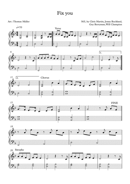 Fix You (arr. Thomas Müller)