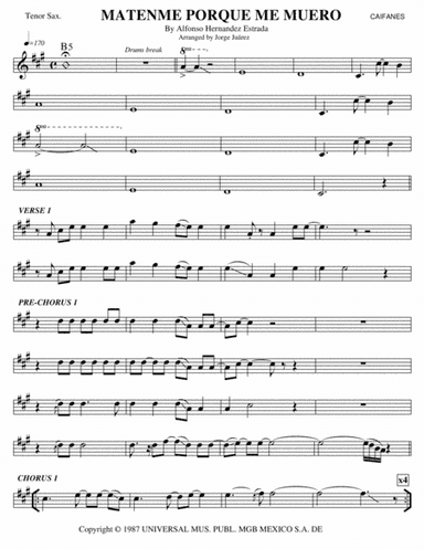Matenme Por Que Me Muero (arr. Jorge Juárez)