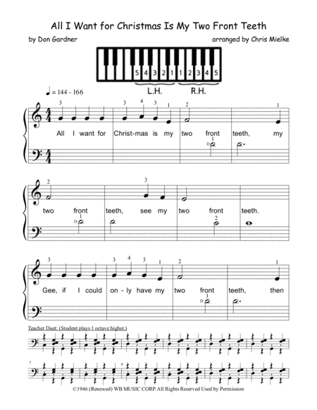 All I Want For Christmas Is My Two Front Teeth (arr. Chris Mielke)