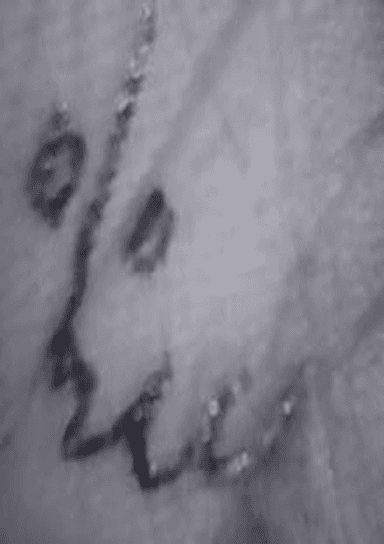 Morse Charang : 003111