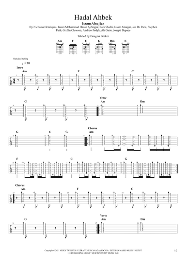 Turning Me Up (hadal Ahbek) (arr. Douglas Becker)