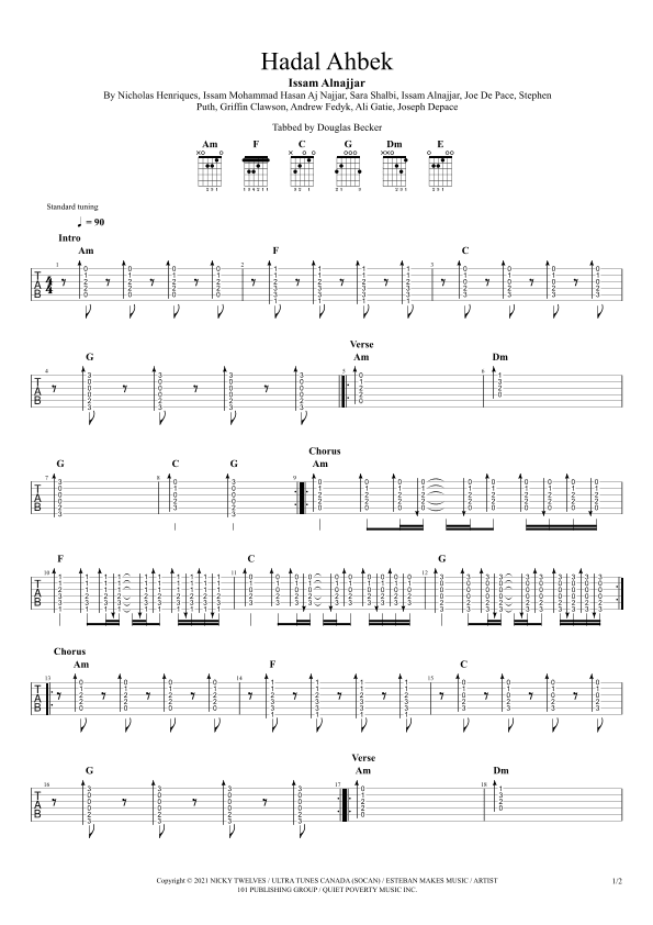Turning Me Up (hadal Ahbek) (arr. Douglas Becker)