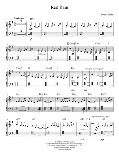 Red Rain (arr. Anthony Prudent)