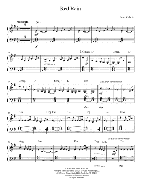 Red Rain (arr. Anthony Prudent)