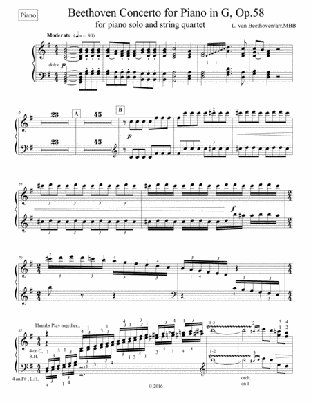 Concertos for Five Beethoven Piano Concerto in G maj, 1st mvnt, arr for String Quartet Piano part on (arr. Michael Bomier)