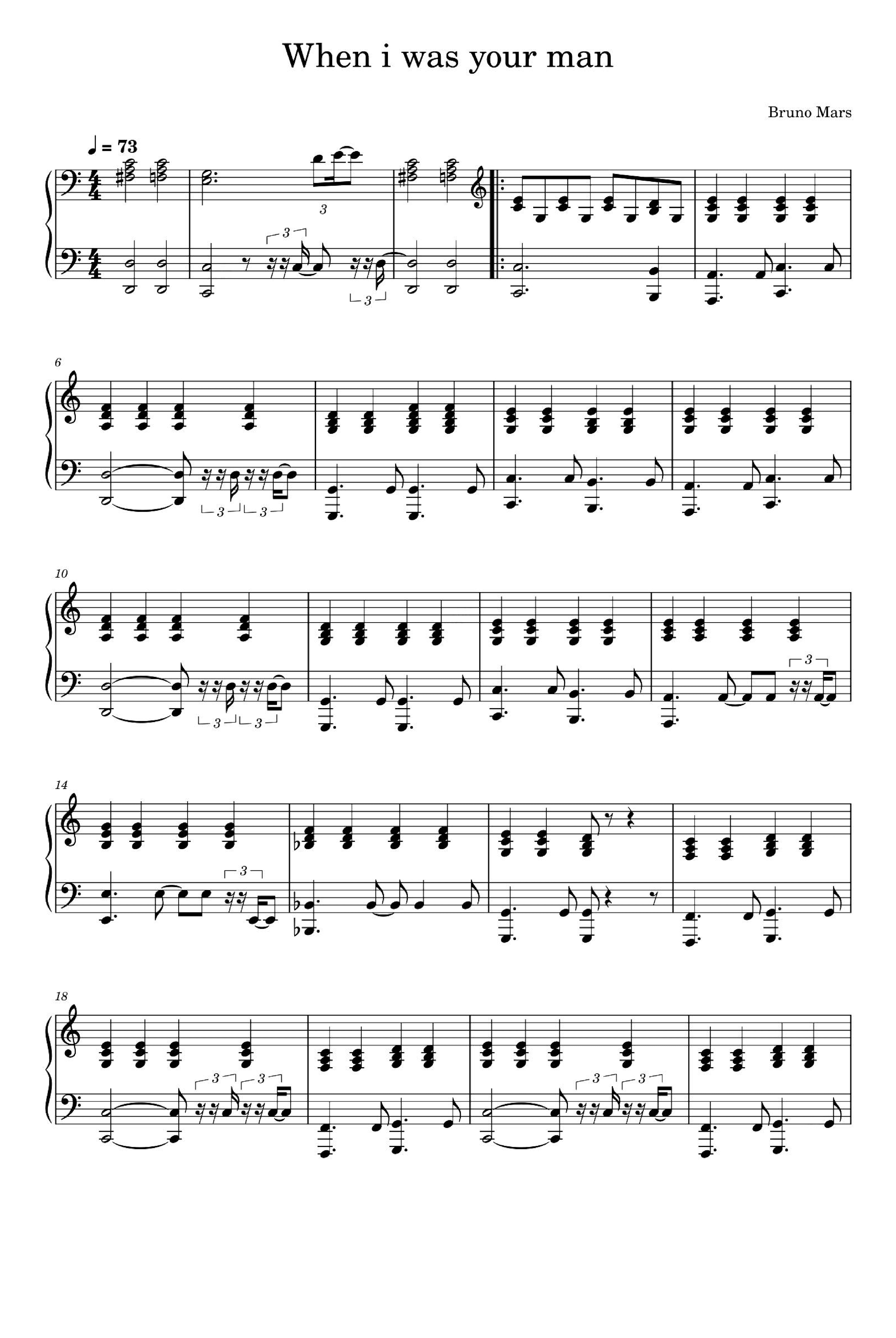 When I Was Your Man (arr. Bruno Mars)