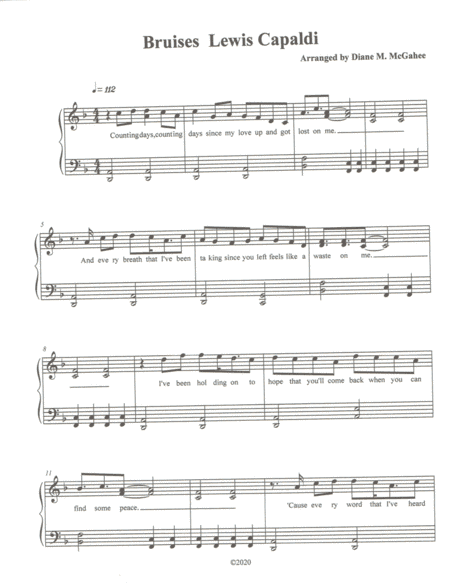Bruises (arr. Diane M. McGahee)