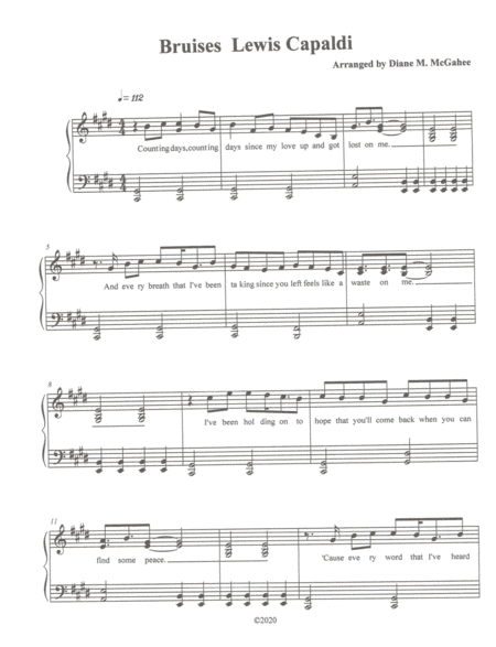 Bruises (arr. Diane M. McGahee)