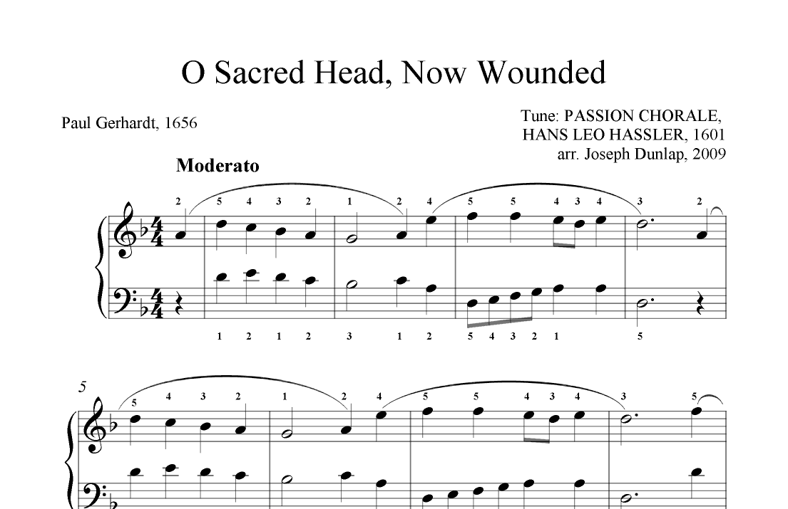O Sacred Head, Now Wounded (arr. Joseph T. Dunlap)