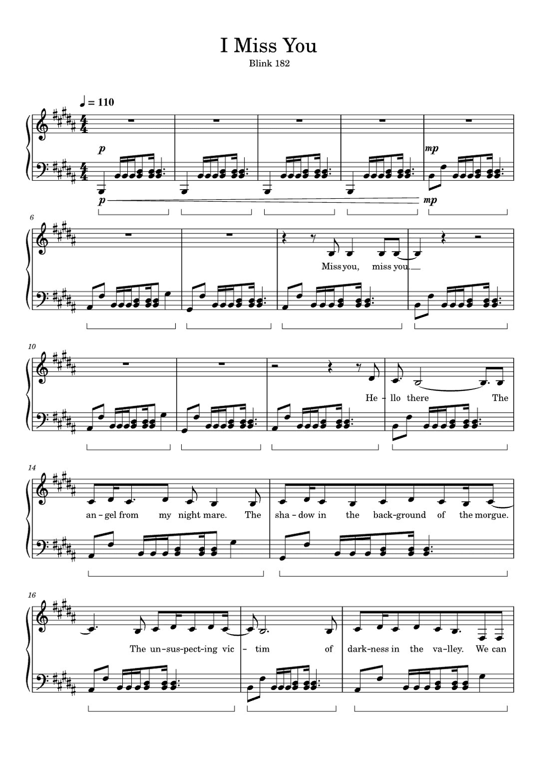 I Miss You (arr. eduardo)