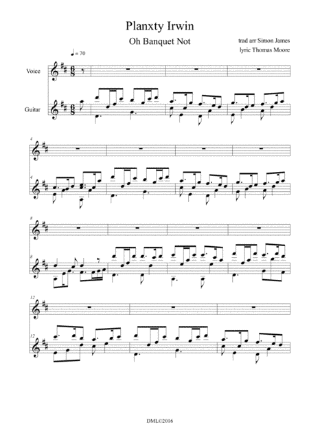 Oh Banquet Not (Planxty Irwin) (arr. Simon James)