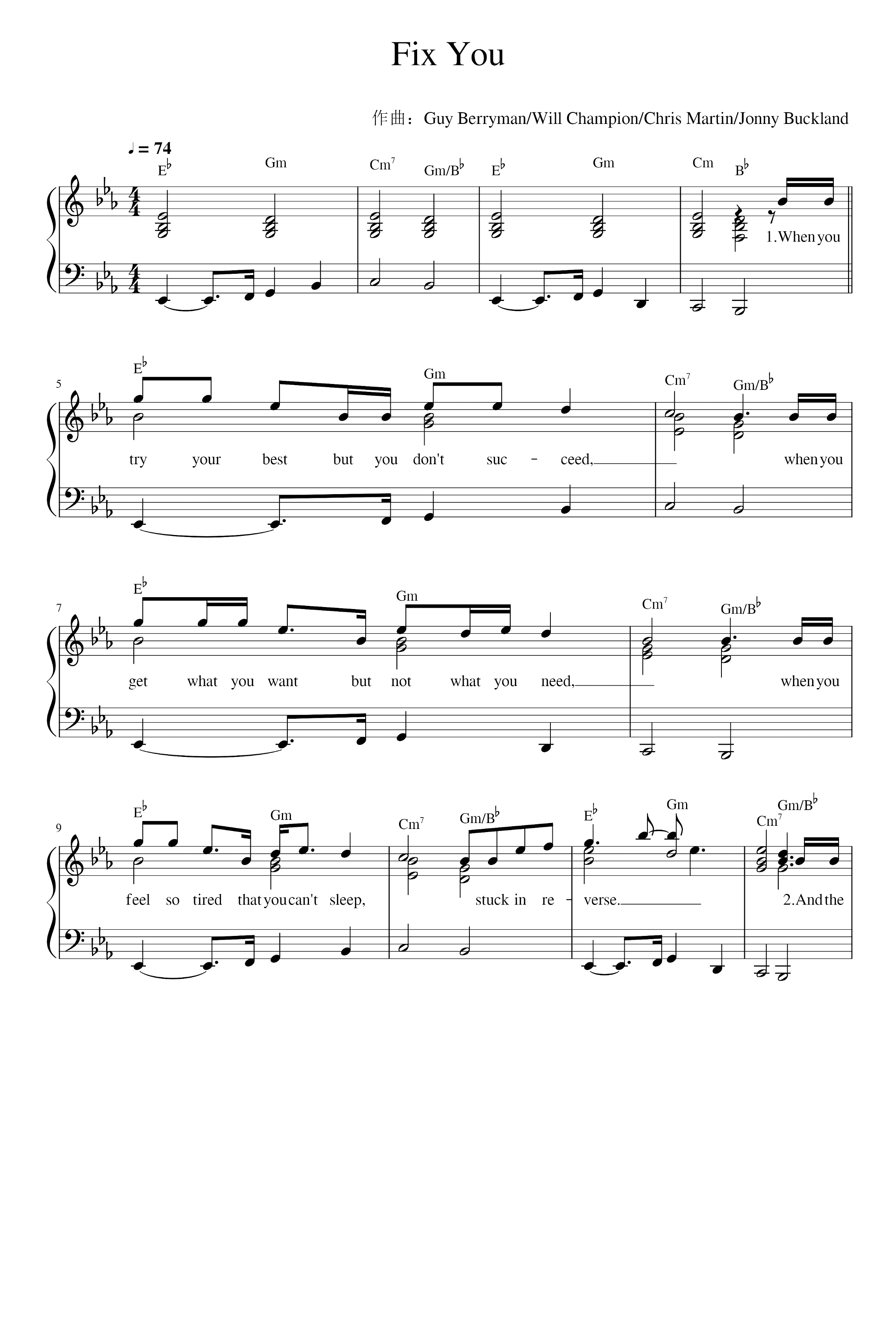 Fix You (arr. Coldplay)