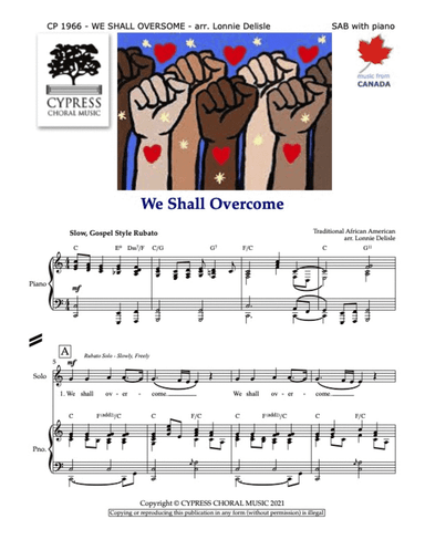 We Shall Overcome SAB