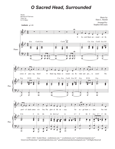 O Sacred Head, Surrounded (Unison choir)