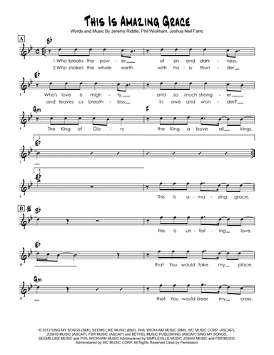 This Is Amazing Grace